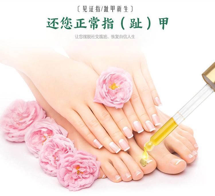 灰指甲液oem貼牌產品