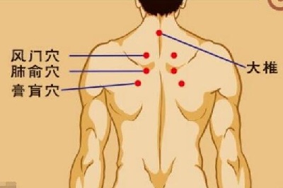 三伏貼連續(xù)貼幾天？看看中醫(yī)師的建議！
